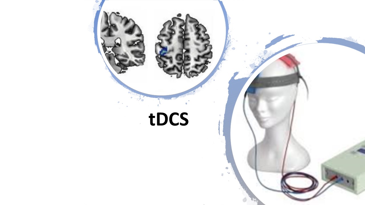 tDCS