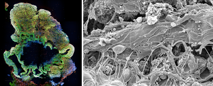 IF and EM imaging of brain organoids used to explore the effect of NE mutations on brain development