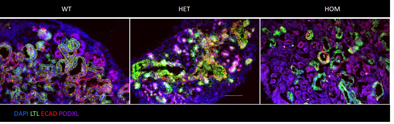 Kidney organoids derived form WT and mutated hPSCs