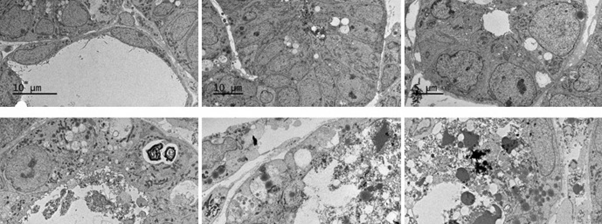 kidney sem